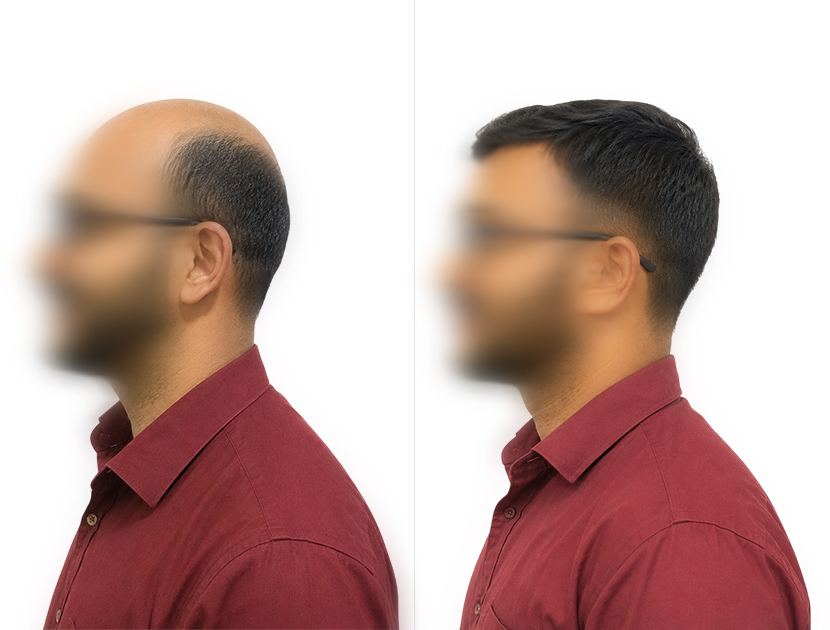 Client hair transformation result