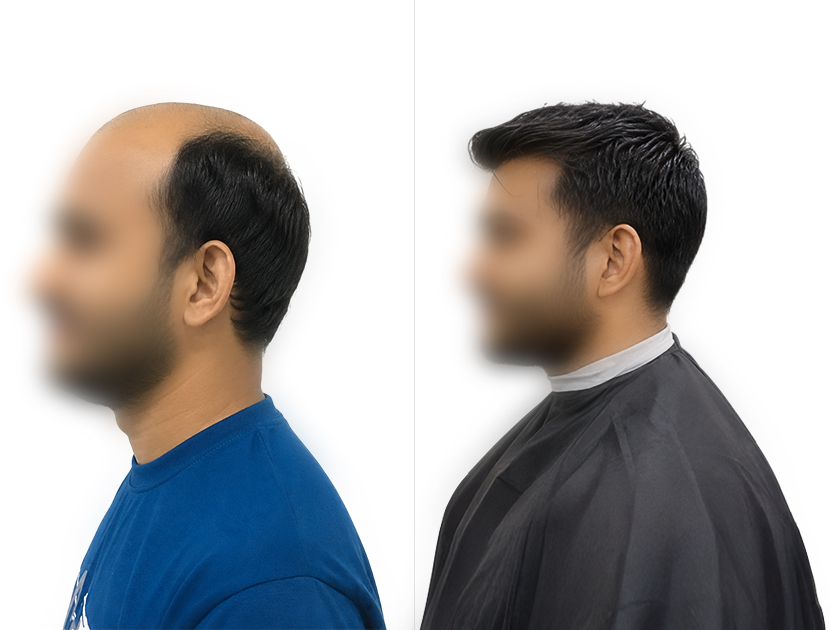 Client hair transformation result