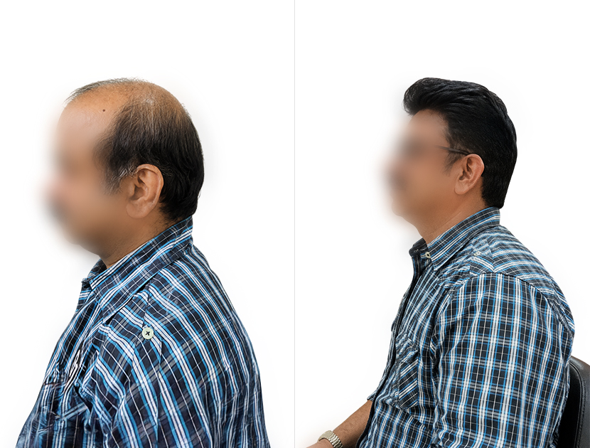 Client hair transformation result